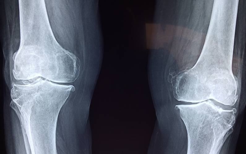 Leczenie bólu kolana